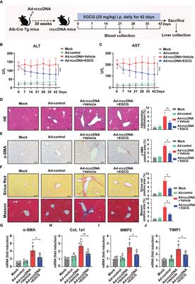 Inhibition of macrophages inflammasome activation via autophagic degradation of HMGB1 by EGCG ameliorates HBV-induced liver injury and fibrosis